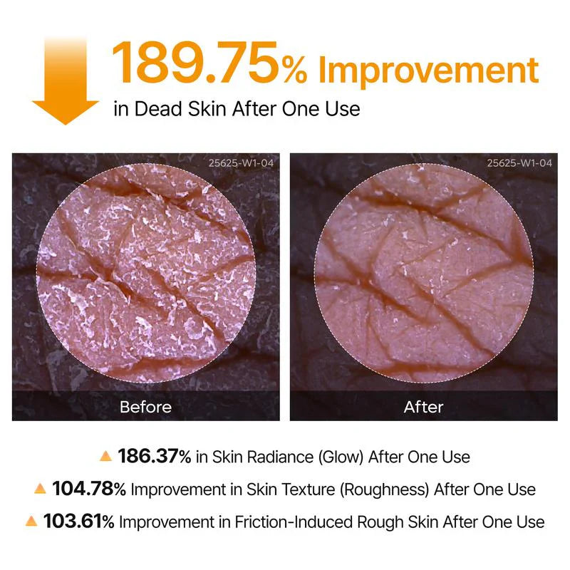 ✨ Clear Body Acne & Rough Skin — Instantly Smooth with Just 1 Spray