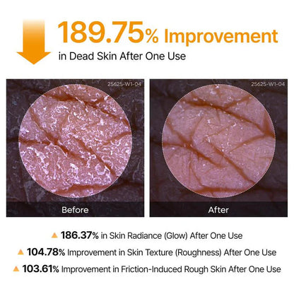 ✨ Clear Body Acne & Rough Skin — Instantly Smooth with Just 1 Spray